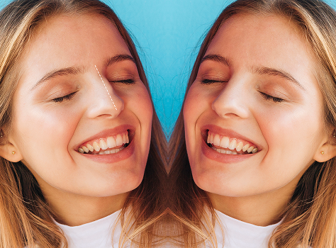 Dental Bridges in tellapur