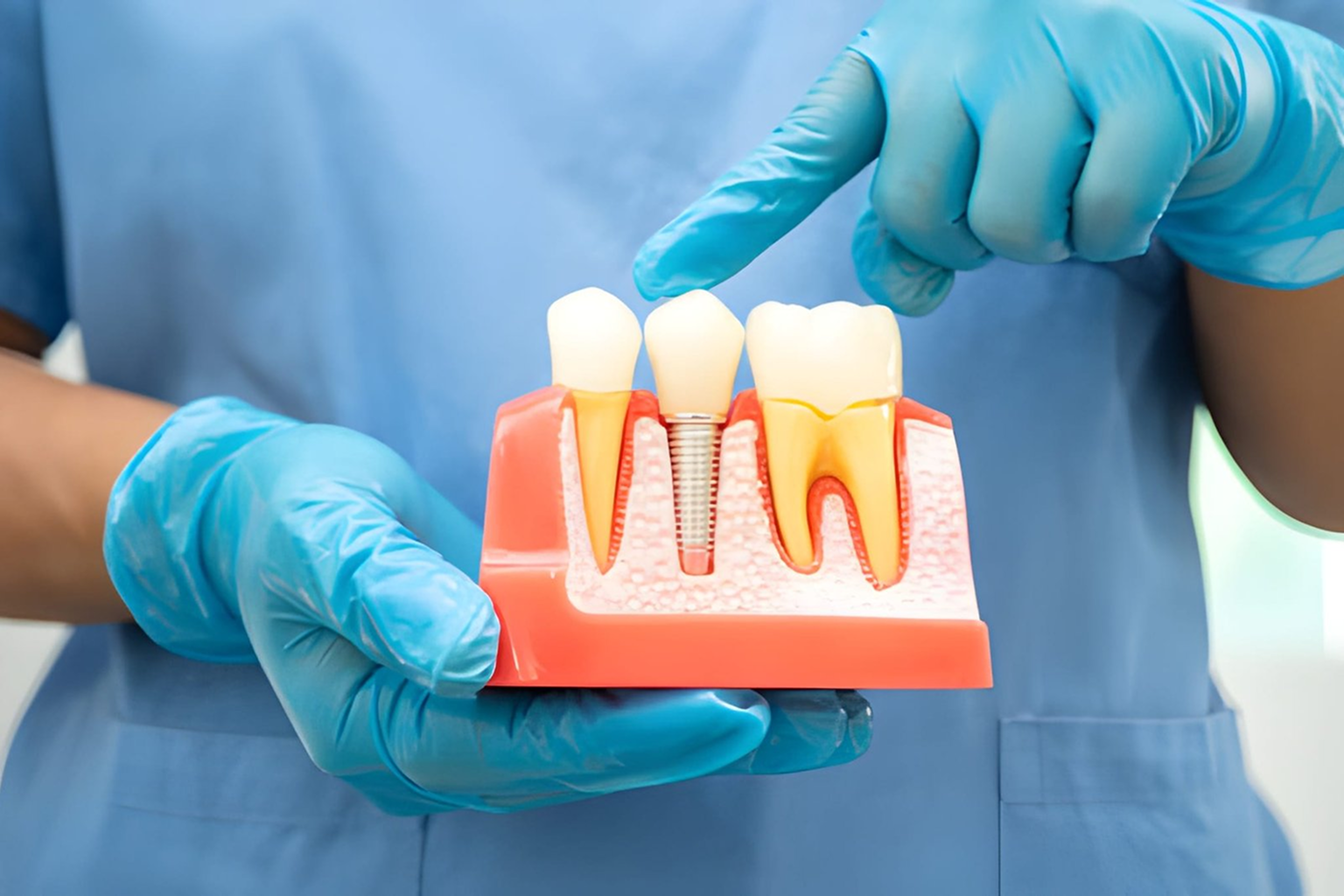 Dental Implants in Kokapet