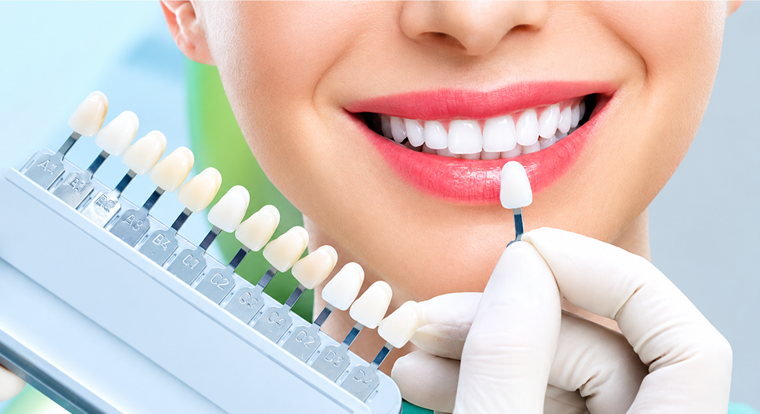 dental veneers in kokapet